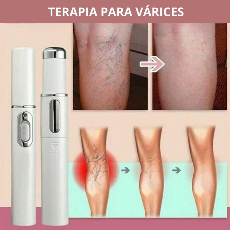LÁSER LIGHT TERAPIA DE LUZ